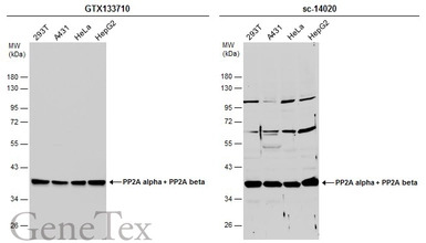PP2A alpha + PP2A beta antibod