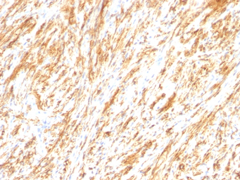 GFAP antibody [SPM248]