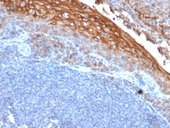 CD146 antibody [MUC18/1130]