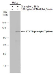 STAT2 (phospho Tyr690) antibod