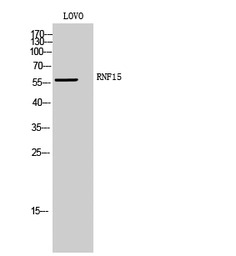 TRIM38 antibody