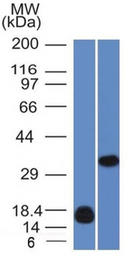 Galectin 13 antibody [PP13/116