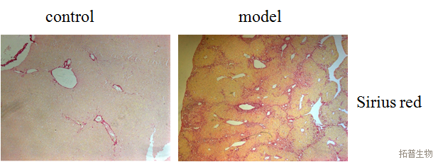 肝纤维化大鼠模型