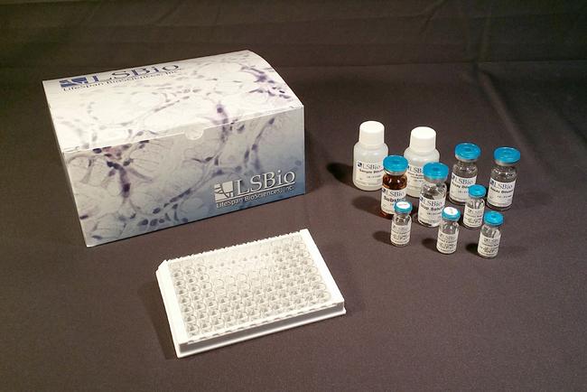 Human IL31 ELISA Kit (Sandwich