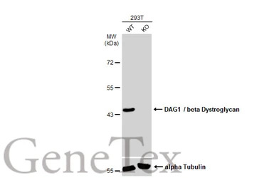DAG1 / beta Dystroglycan antib
