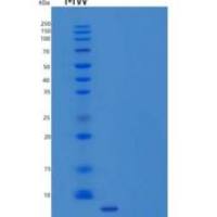 人防御素β4(DEFb4)重组蛋白