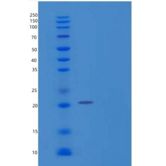 小鼠TREM-1/CD354重组蛋白C-6His