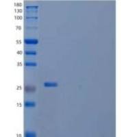 人R-脊椎蛋白1(RSPO1)重组蛋白C-6His