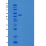 人塞尔平·E1/PAI-1重组蛋白C-6His