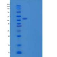 人塞尔平·E1/PAI-1重组蛋白C-6His