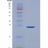 人CD32a / FCGR2A重组蛋白167 Arg, His & AVI tag