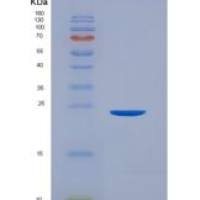人CD32a / FCGR2A重组蛋白167 Arg, His & AVI tag