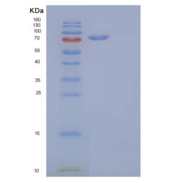 人KSP钙黏蛋白(CDH16)重组蛋白C-6His