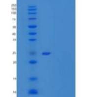 人白介素-22受体亚单位α-2/Interleukin-22重组蛋白