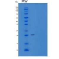 人蛋白磷酸酶1调节亚单位1A/PPP1R1A重组蛋白C-6His