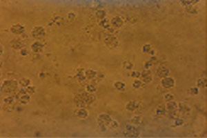 CM-cell apoptosis-138x102XIUGA