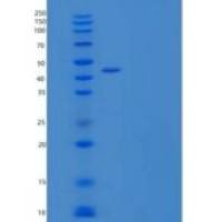 人卵磷脂胆固醇脂酰转移酶(LCAT)重组蛋白C-6His