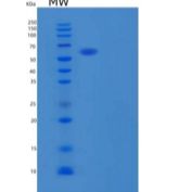 人GALNTL1重组蛋白C-6His