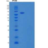 人GALNTL1重组蛋白C-6His