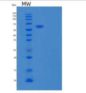 人GALNTL1重组蛋白C-6His