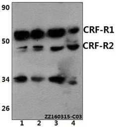 CRHR1 + CRHR2 antibody