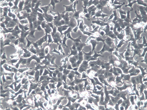 INS-1 细胞、INS-1大鼠胰岛细胞瘤细胞