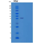人β-1,4-半乳糖转移酶4(b4GALT4)重组蛋白C-6