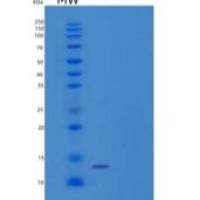 人催泪蛋白(LACRT)重组蛋白N-6His