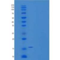 人微管相关蛋白τ/MAPT-D/τ-D重组蛋白C-6His