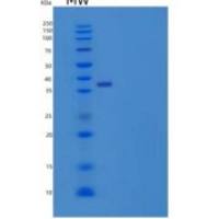 人肺表面活性物质相关蛋白D/PSP-D重组蛋白C-6His
