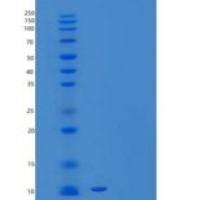 人降钙素/钙重组蛋白C-6His, E. coli
