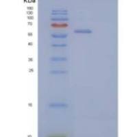 人亮氨酸丰富α2-糖蛋白1(LRG1)重组蛋白C-Fc-6His