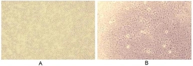 Human Factor B (Ba fragment) p