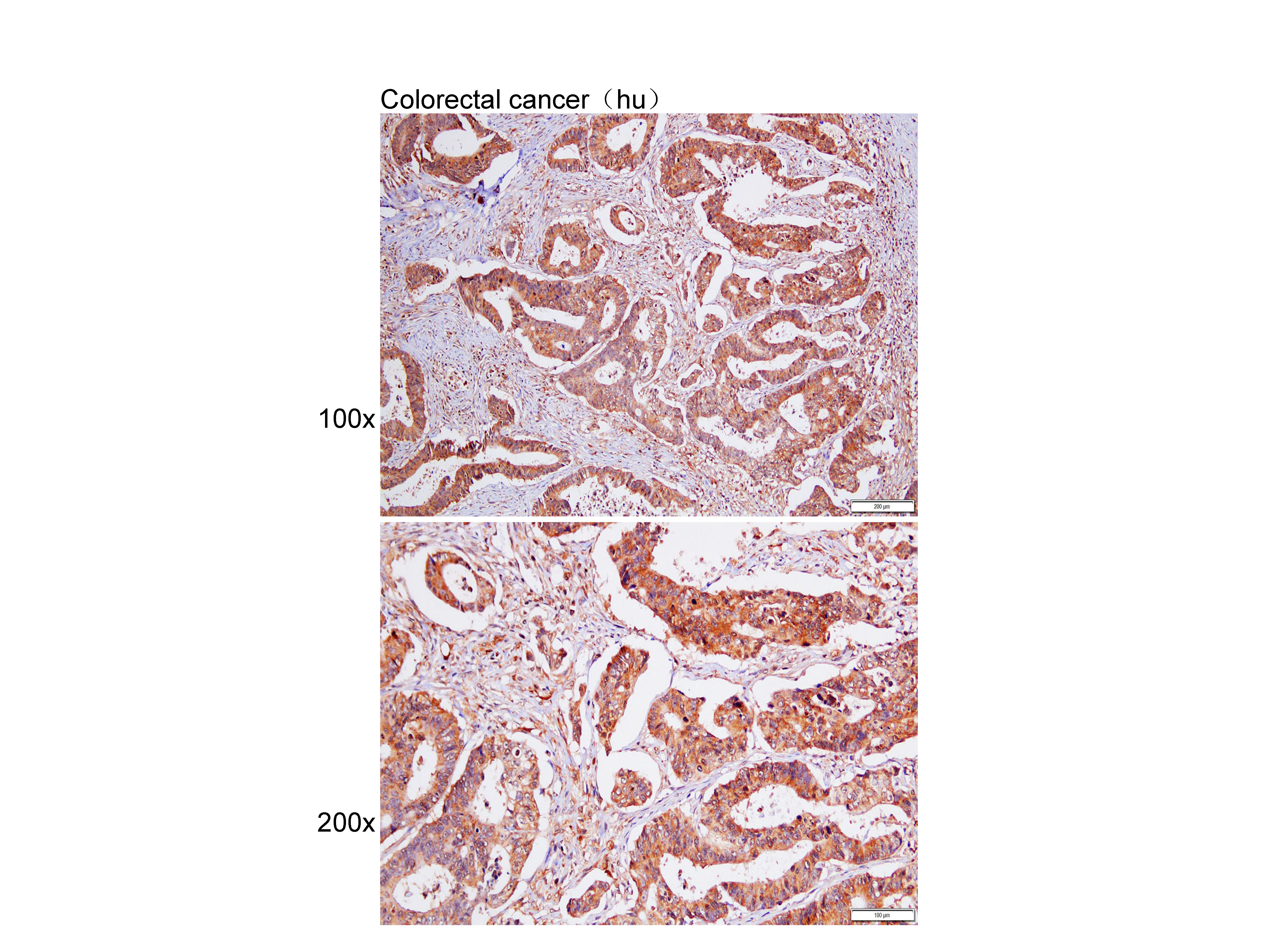 Anti-PSMD14 Polyclonal Antibod