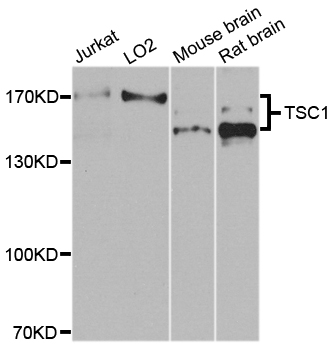 Anti-TSC1 Polyclonal Antibody
