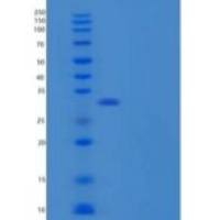 人Carbonic Anhydrase 10/CA10重组蛋白C-6His