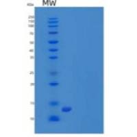 人t细胞表面糖蛋白CD3链重组蛋白