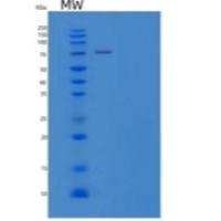 人原钙黏素10(PCDH10)重组蛋白C-6His