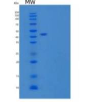 人血清a6/反式皮质酮重组蛋白C-6His