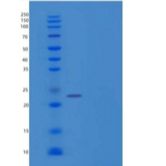 人p53反应基因3(PRG3)重组蛋白C-6His