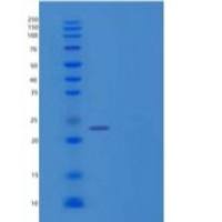 人p53反应基因3(PRG3)重组蛋白C-6His