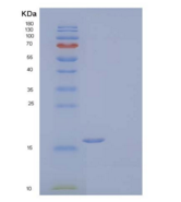 人视黄酸受体反应蛋白2/Chemerin/TIG2重组蛋白C