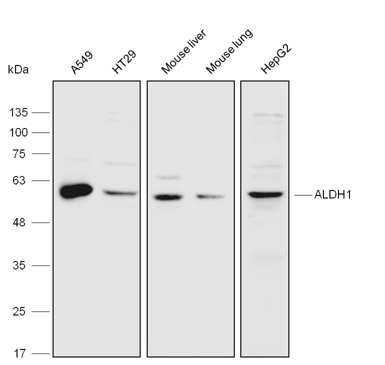 Anti-ALDH1 Polyclonal Antibody