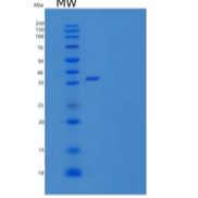 人雌激素受体β/ERβ/NR3A2重组蛋白N-6His