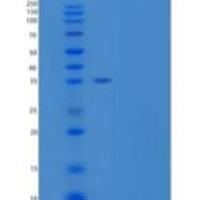 小鼠载脂蛋白E(APOE)重组蛋白C-6His