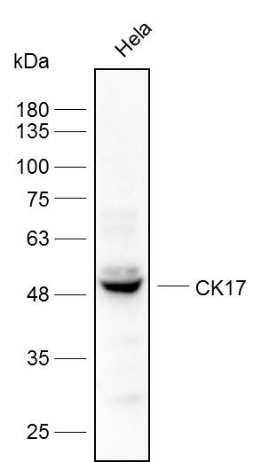 Anti-CK17 Polyclonal Antibody
