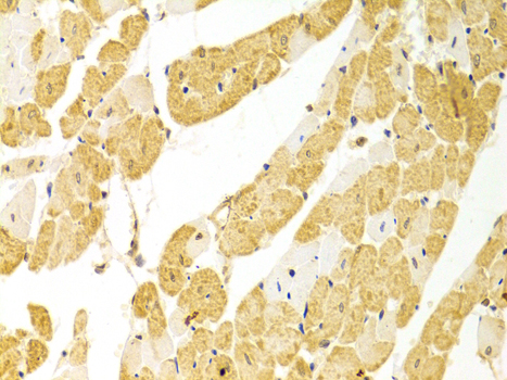 Anti-PLCB1 Polyclonal Antibody