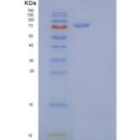 人KSP钙黏蛋白(CDH16)重组蛋白C-6His