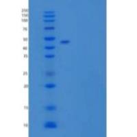 人羧肽酶A1(CPA1)重组蛋白C-6His