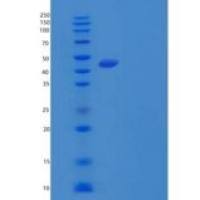 人肝配蛋白A5(EFNA5)重组蛋白C-Fc